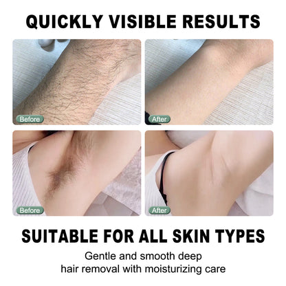 AgeVance Cyperus Rotundus Hair Removal Cream